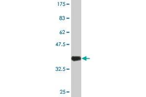 Western Blot detection against Immunogen (36. (SHC3 antibody  (AA 381-480))