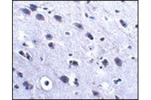 Immunohistochemistry (Paraffin-embedded Sections) (IHC (p)) image for anti-Leucine Rich Repeat and Fibronectin Type III Domain Containing 2 (LRFN2) (C-Term) antibody (ABIN500188)