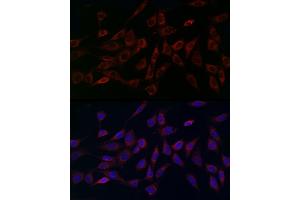 MCU antibody  (AA 1-351)