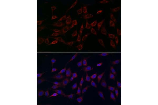 MCU antibody  (AA 1-351)