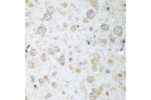 Immunohistochemistry of paraffin-embedded mouse brain using TRH antibody at dilution of 1:100 (40x lens). (TRH antibody)