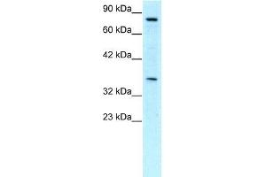 Human Jurkat; WB Suggested Anti-NPAS1 Antibody Titration: 0. (NPAS1 antibody  (C-Term))
