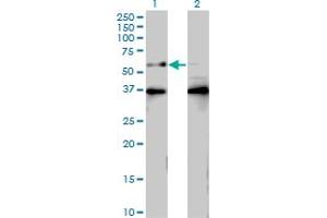 Western Blot analysis of BTBD9 expression in transfected 293T cell line by BTBD9 monoclonal antibody (M01), clone 3H3.