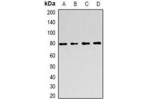 Western blot analysis of FOXP2 expression in THP1 (A), Hela (B), SHSY5Y (C), mouse liver (D) whole cell lysates. (FOXP2 antibody)