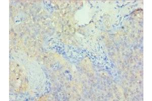 Immunohistochemistry (IHC) image for anti-PDZ and LIM Domain 1 (PDLIM1) (AA 1-329) antibody (ABIN7162721)