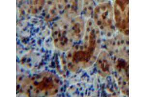 Used in DAB staining on fromalin fixed paraffin-embedded kidney tissue (ACP1 antibody  (AA 1-158))