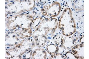 Immunohistochemical staining of paraffin-embedded Ovary tissue using anti-ACO2mouse monoclonal antibody.