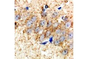 Immunohistochemical analysis of HSD17B2 staining in rat brain  formalin fixed paraffin embedded tissue section. (HSD17B2 antibody)