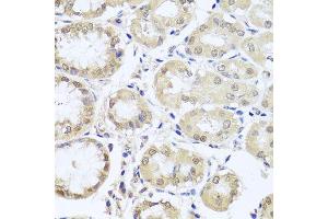 Immunohistochemistry of paraffin-embedded human stomach using CGB7 antibody (ABIN5974696) at dilution of 1/100 (40x lens). (CGB7 antibody)