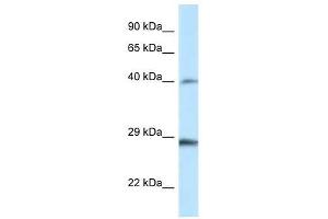 Western Blot showing Hoxb9 antibody used at a concentration of 1. (HOXB9 antibody  (Middle Region))