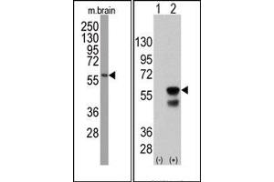 Western Blotting (WB) image for anti-PTEN Induced Putative Kinase 1 (PINK1) antibody (ABIN356391) (PINK1 antibody)