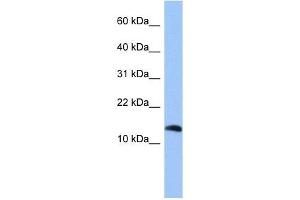 Western Blotting (WB) image for anti-Parathyroid Hormone 2 (PTH2) (Middle Region) antibody (ABIN636078)