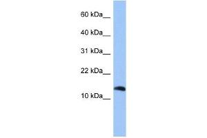 PTH2 antibody used at 1 ug/ml to detect target protein. (Parathyroid Hormone 2 (PTH2) (Middle Region) antibody)