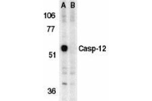 Western blot analysis of caspase-12 in mouse brain tissue lysate in the absence (A) or presence (B) of blocking peptide with AP30191PU-N caspase-12 antibody (IN) at 1 μg/ml. (Caspase 12 antibody  (Intermediate Domain))