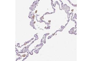Immunohistochemical staining (Formalin-fixed paraffin-embedded sections) of human lung with SIGLEC1 polyclonal antibody  shows distinct membranous positivity in macrophages. (Sialoadhesin/CD169 antibody  (AA 1425-1510))