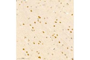Immunohistochemistry of paraffin embedded mouse brain using RAPGEF5 (ABIN7075365) at dilution of 1:700 (400x lens)