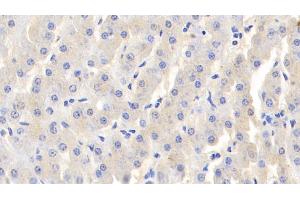 Detection of LTF in Bovine Liver Tissue using Polyclonal Antibody to Lactoferrin (LTF) (Lactoferrin antibody  (AA 25-352))