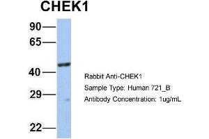 Western Blotting (WB) image for anti-Checkpoint Kinase 1 (CHEK1) (Middle Region) antibody (ABIN2779737)