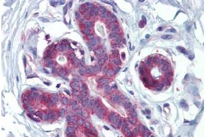 Human Breast (formalin-fixed, paraffin-embedded) stained with HOXA5 antibody ABIN462218 followed by biotinylated goat anti-rabbit IgG secondary antibody ABIN481713, alkaline phosphatase-streptavidin and chromogen. (HOXA5 antibody  (C-Term))