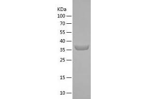 Western Blotting (WB) image for Mitochondrial Ribosomal Protein L53 (MRPL53) (AA 1-112) protein (His-IF2DI Tag) (ABIN7282331) (MRPL53 Protein (AA 1-112) (His-IF2DI Tag))