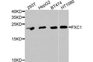 Western blot analysis of extracts of various cell lines, using TIMM10B antibody. (TIMM10B antibody)
