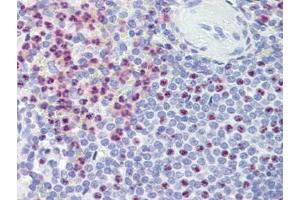 Spleen, Human: Formalin-Fixed, Paraffin-Embedded (FFPE) (PKD1 antibody)