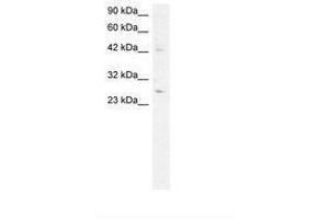 Image no. 2 for anti-Adiponectin (ADIPOQ) (AA 77-126) antibody (ABIN202115) (ADIPOQ antibody  (AA 77-126))