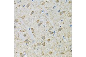 Immunohistochemistry of paraffin-embedded mouse brain using DHRS2 antibody. (DHRS2 antibody  (AA 1-300))
