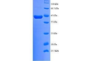 NDUFB7 Protein (AA 2-137) (GST tag)
