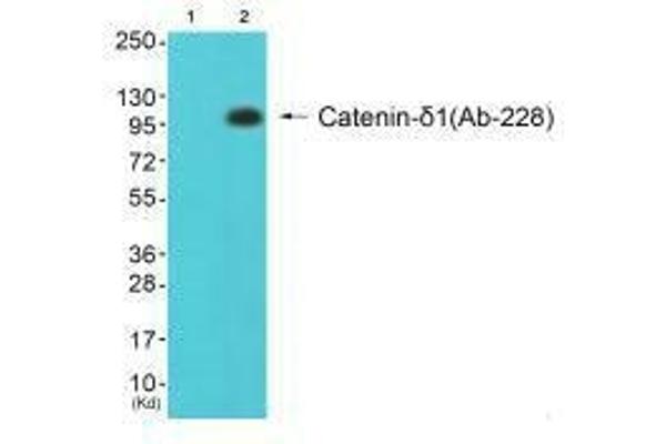 CTNND1 Antikörper  (Tyr228)