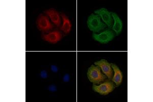 ABIN6255757 and ABIN6267340 staining Hela cells(4h of LPS treatment) by IF/ICC. (c-MET antibody  (pTyr1003))