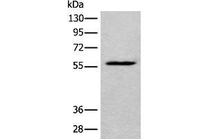 Western blot analysis of HEPG2 cell lysate using LDHD Polyclonal Antibody at dilution of 1:400 (LDHD antibody)