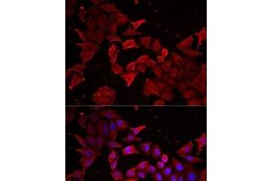 Immunofluorescence analysis of MCF7 cells using Caspase-14 Polyclonal Antibody (CASP14 antibody)