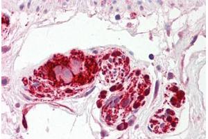 Image no. 2 for anti-Intraflagellar Transport 172 Homolog (IFT172) (AA 360-409) antibody (ABIN6749751) (IFT172 antibody  (AA 360-409))
