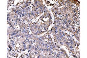 IHC analysis of RAE1 using anti-RAE1 antibody (ABIN7602428). (RAE1 antibody  (AA 76-368))
