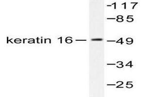 Image no. 1 for anti-Keratin 16 (KRT16) antibody (ABIN265495) (KRT16 antibody)
