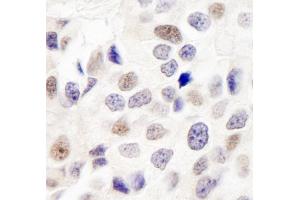 Immunohistochemistry (IHC) image for anti-Integrator Complex Subunit 7 (INTS7) (AA 850-900) antibody (ABIN7449405) (INTS7 antibody  (AA 850-900))