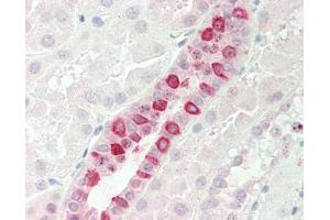 Human Kidney: Formalin-Fixed, Paraffin-Embedded (FFPE). (RBM5 antibody  (N-Term))