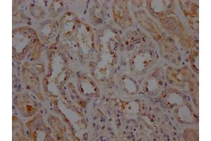 IHC image of  diluted at 1:100 and staining in paraffin-embedded human kidney tissue performed on a Leica BondTM system.