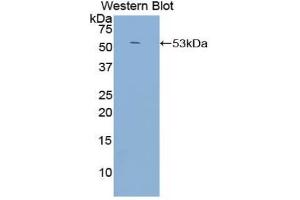 Western blot analysis of the recombinant protein. (CD21 antibody  (AA 729-957))