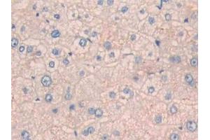 Detection of CPN1 in Human Liver Tissue using Polyclonal Antibody to Carboxypeptidase N1 (CPN1) (CPN1 antibody  (AA 159-325))