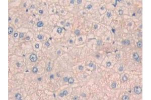 Detection of CPN1 in Human Liver Tissue using Polyclonal Antibody to Carboxypeptidase N1 (CPN1)
