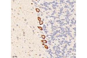 Immunohistochemistry analysis of paraffin-embedded rat cerebellum using,Dgkz (ABIN7073722) at dilution of 1: 6000 (DGKZ antibody)