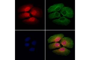 ABIN7094127 and ABIN7098171 staining Hela cells by IF/ICC. (CHMP1A antibody  (C-Term))