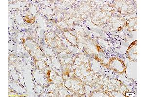 Formalin-fixed and paraffin embedded mouse kidney tissue labeled with Anti-MCKD2/UMOD Polyclonal Antibody, Unconjugated (ABIN678473) at 1:200 followed by conjugation to the secondary antibody and DAB staining