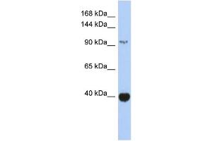 WB Suggested Anti-ZBTB4 Antibody Titration: 0. (ZBTB4 antibody  (Middle Region))