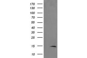 Image no. 1 for anti-TSC22 Domain Family, Member 3 (TSC22D3) antibody (ABIN1498455) (TSC22D3 antibody)
