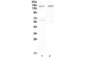 Western blot testing of human 1) U-87 MG and 2) SHG-4 cell lysate with Neurexin antibody at 0. (Neurexin 1 antibody)