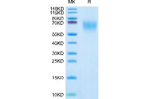 Cynomolgus CEACAM-6 on Tris-Bis PAGE under reduced condition. (CEACAM6 Protein (AA 35-320) (His tag))