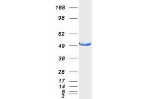Validation with Western Blot (IFT57 Protein (Myc-DYKDDDDK Tag))
